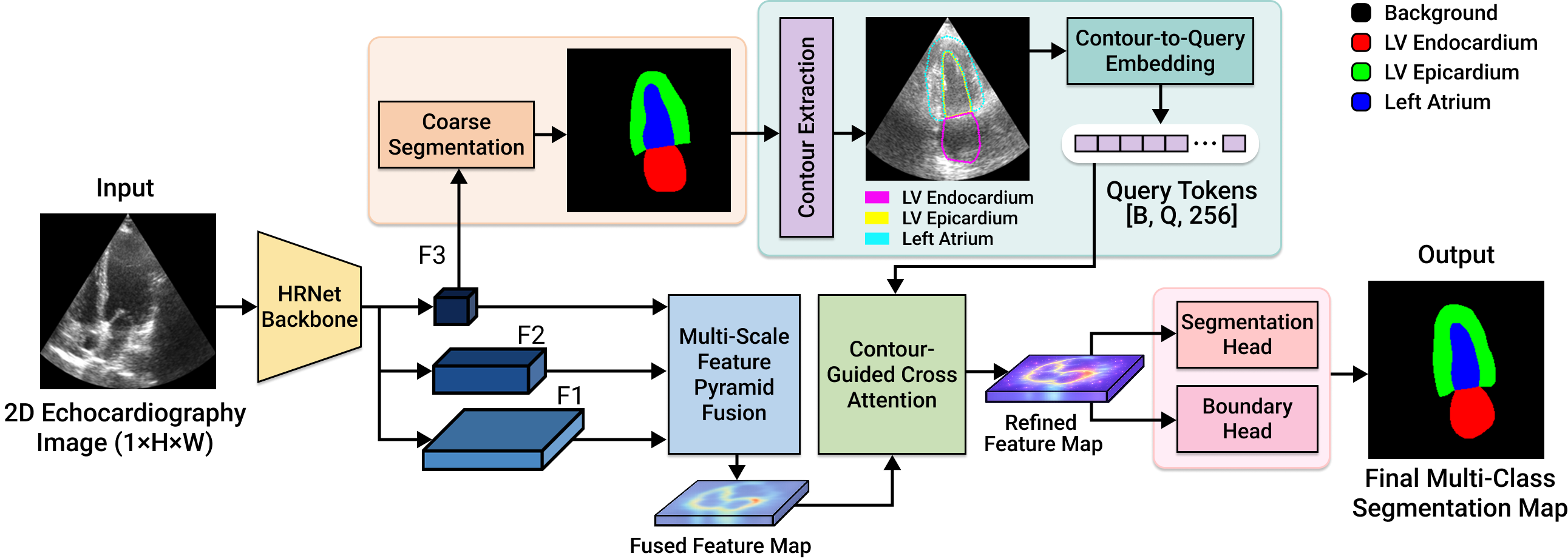 CGQR-Net architecture figure